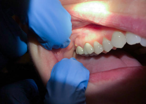 Best Dental Emergency Near Me  in Fox River Grove, IL