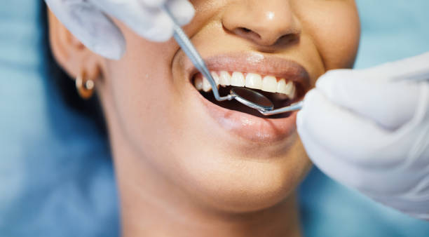 Urgent Tooth Repair in IL